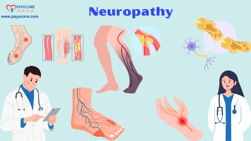 Neuropathy: Types, Causes, Symptoms, Prevention Neuropathy: Types, Causes, Symptoms, Prevention